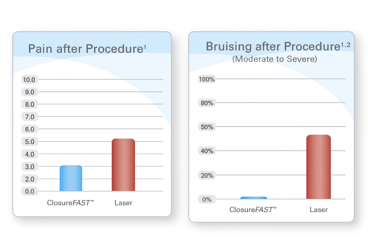 ClosureFAST™ vs Laser outcomes—Swindon Vein Clinic graph showing lower pain and bruising with ClosureFAST™ ClosureFAST™ vs Laser outcomes—Swindon Vein Clinic graph showing lower pain and bruising with ClosureFAST™
